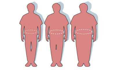 Obesity