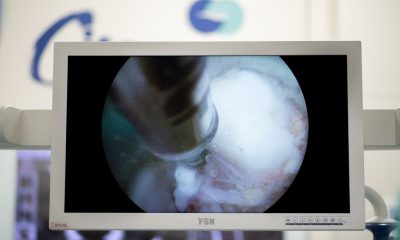 endoskopowe operacje kregoslupa - torun